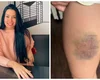 Nutricionista lutou por 13 minutos contra agressor que invadiu sua casa para estuprá-la: 'Briguei pela vida'
