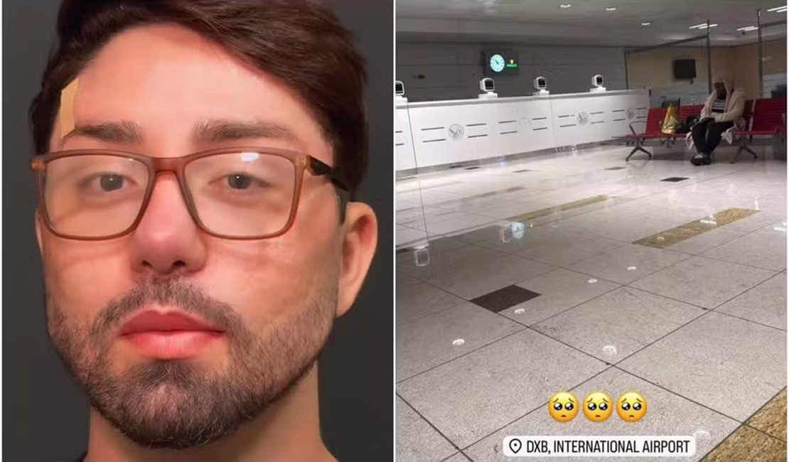 Rico Melquiades faz harmonização e é parado em aeroporto: 'Alegando que não sou a mesma pessoa'
