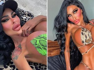 'Barbie humana' revela ter gasto mais de R$ 1 milhão em cirurgias plásticas