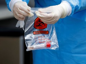 Covid-19: 500 mil kits de teste rápido chegam ao Brasil