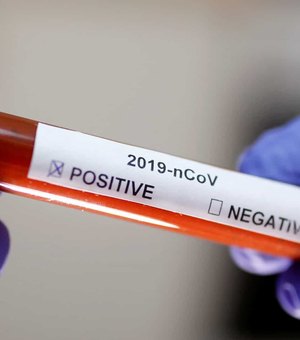 Coronavírus: laboratório britânico dará R$ 20 mil para quem testar vacina