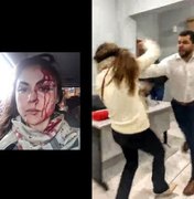 Procuradora é brutalmente agredida por colega em SP após abertura de processo disciplinar contra o agressor