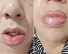 Colgate decide parar de fabricar o creme dental Clean Mint após reações alérgicas