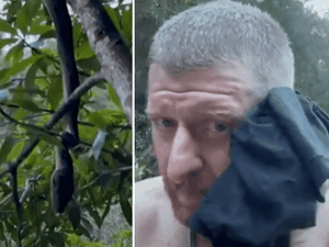 [Vídeo]   Homem é mordido no rosto ao tentar gravar serpente de perto na Austrália