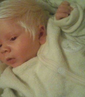 Bebê faz sucesso ao nascer com o cabelo todo branco