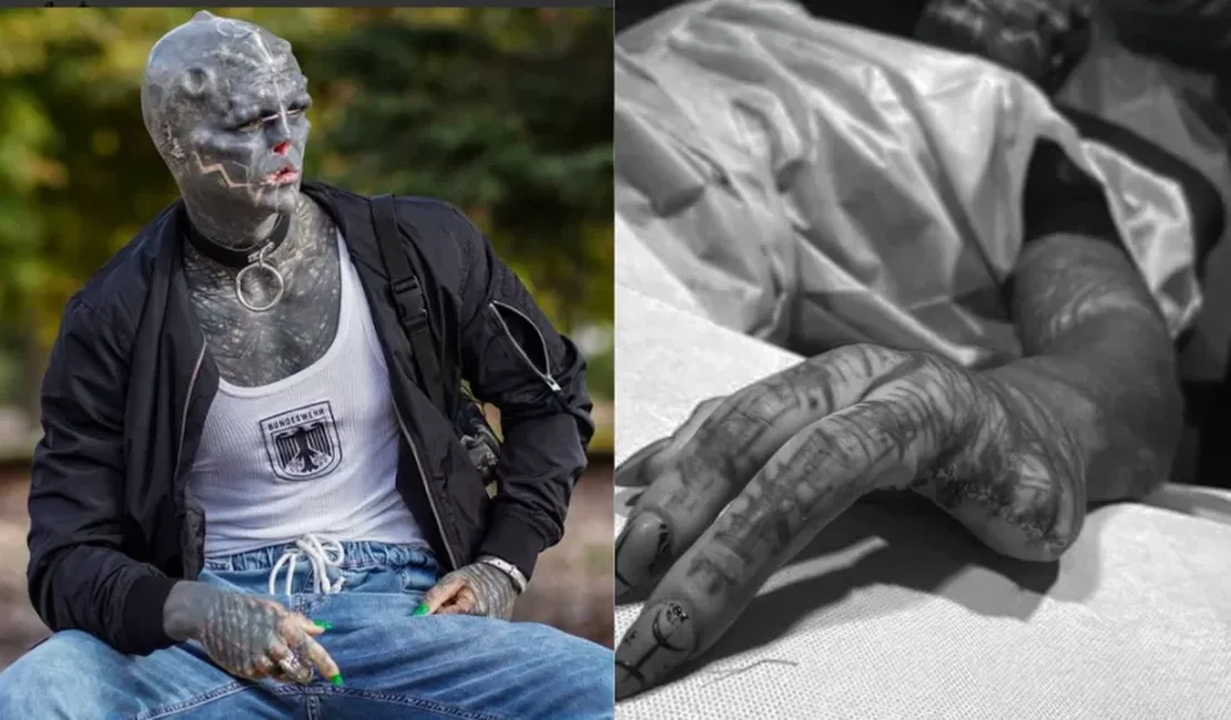 Homem amputa os dedos para se parecer mais com 'alienígena sombrio'