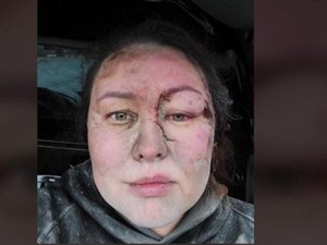 Treinadora ucraniana é 'enterrada viva' e choca em meio à guerra