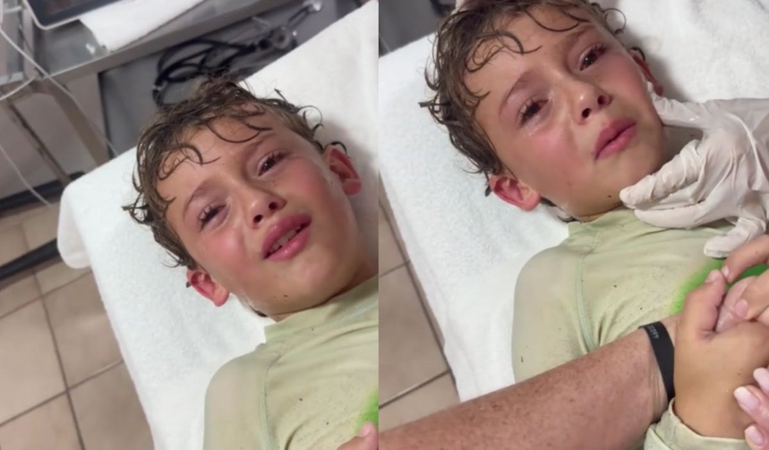 Caranguejo é retirado vivo do ouvido de um menino após dia de praia
