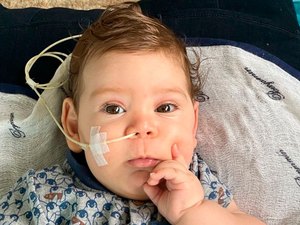 União Federal recorre e suspende fornecimento de medicamento de R$ 12 milhões a bebê de 5 meses