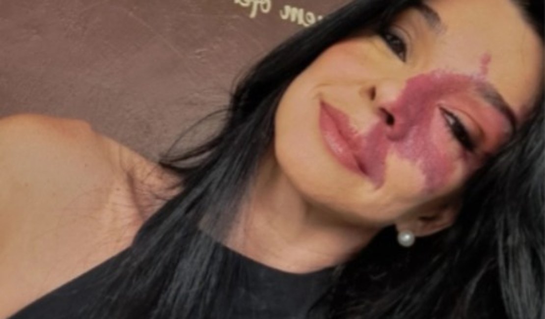 Empresária de Maceió morre em consequência de câncer cerebral