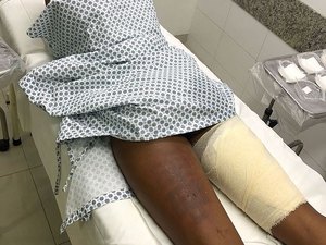 Clínica que fez fotodepilação em modelo já havia sido denunciada ao MP