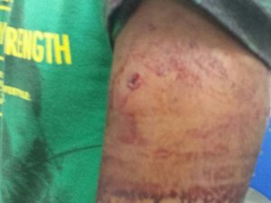 Jovem é baleado na saída de clube social de Arapiraca