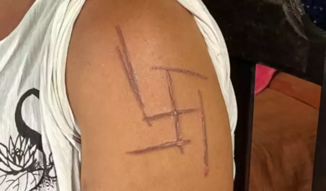 Mulher trans é marcada por suástica nazista após ser espancada por namorado e patrões