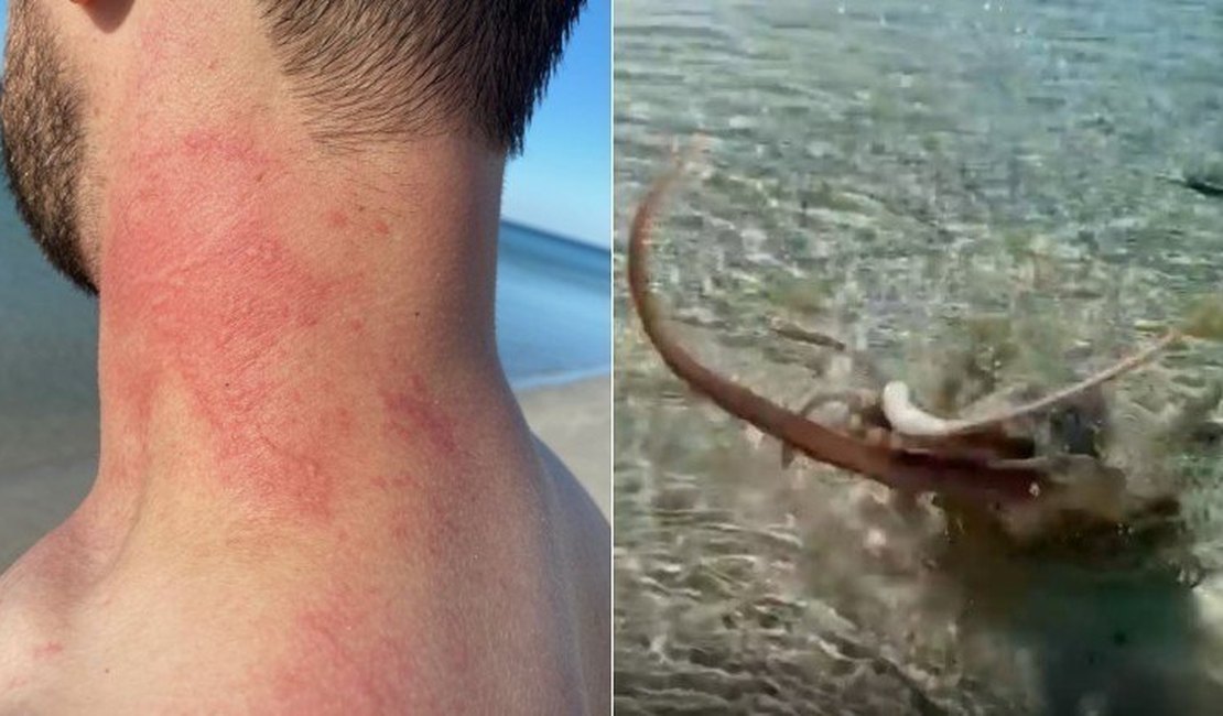 Polvo ataca banhista em praia na Austrália