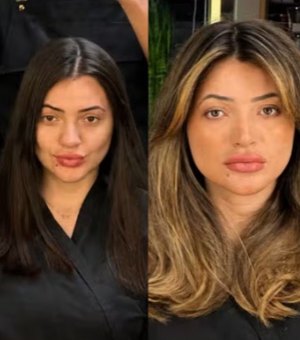 Veja antes e depois de suspeita de dar facada em cabeleireiro em SP