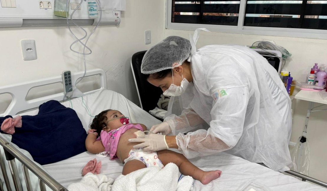 Enfermeiras alertam sobre o que fazer em caso de queimaduras nas festas juninas
