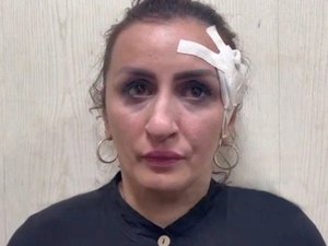Mãe é presa após vender bebê para pagar operação de R$ 19.000 no nariz