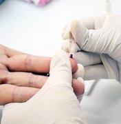 Testes de HIV revelam casos positivos acima da média do vírus em Alagoas