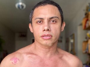 Ator Silvero Pereira revela ter sido estuprado aos 7 anos