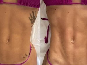 Virginia Fonseca mostra a barriga antes e depois de fazer massagem modeladora