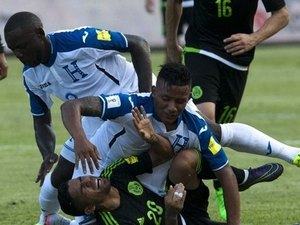 [Vídeo] Jogador de Honduras sofre fratura exposta em jogo