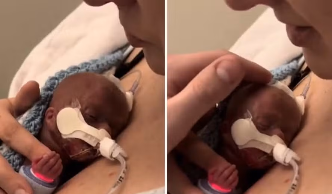 Mulher abraça seu bebê prematuro em 'despedida', mas acaba surpreendida pelo desfecho