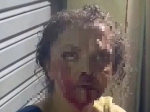 Mulher é brutalmente agredida em via pública em Quebrangulo