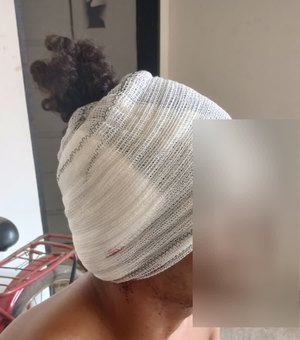 Mulher ataca companheiro com facão por não deixá-la entrar em casa na zona rural de Feira Grande