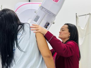 Outubro Rosa: Hospital da Mulher de Alagoas disponibiliza mamografia sem precisar agendar