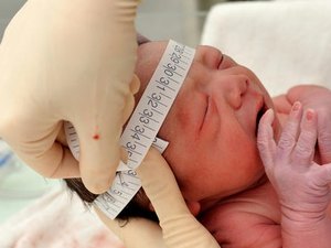 Protocolo de Pernambuco sobre microcefalia será usado no mundo