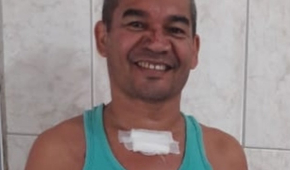 Paciente de São Paulo agradece equipe do HE do Agreste que salvou a vida dele após incêndio