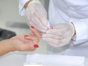 Ampliação de testes rápidos de HIV aumenta diagnósticos de Aids em Alagoas
