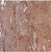 [Vídeo] Moradora denuncia rua esburacada no bairro Capiatã, em Arapiraca