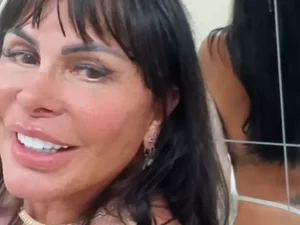 Gretchen comemora resultado de novo procedimento: 'Bumbum na nuca'