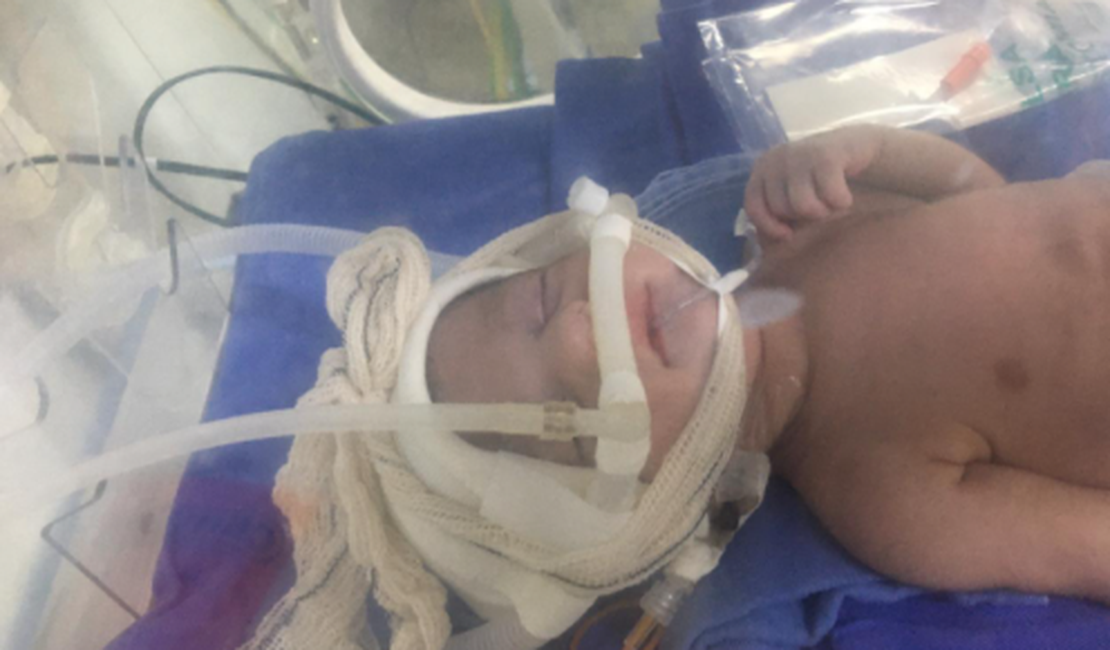 João Arthur: bebê com fibrose cística é transferido para a Santa Casa, em Maceió