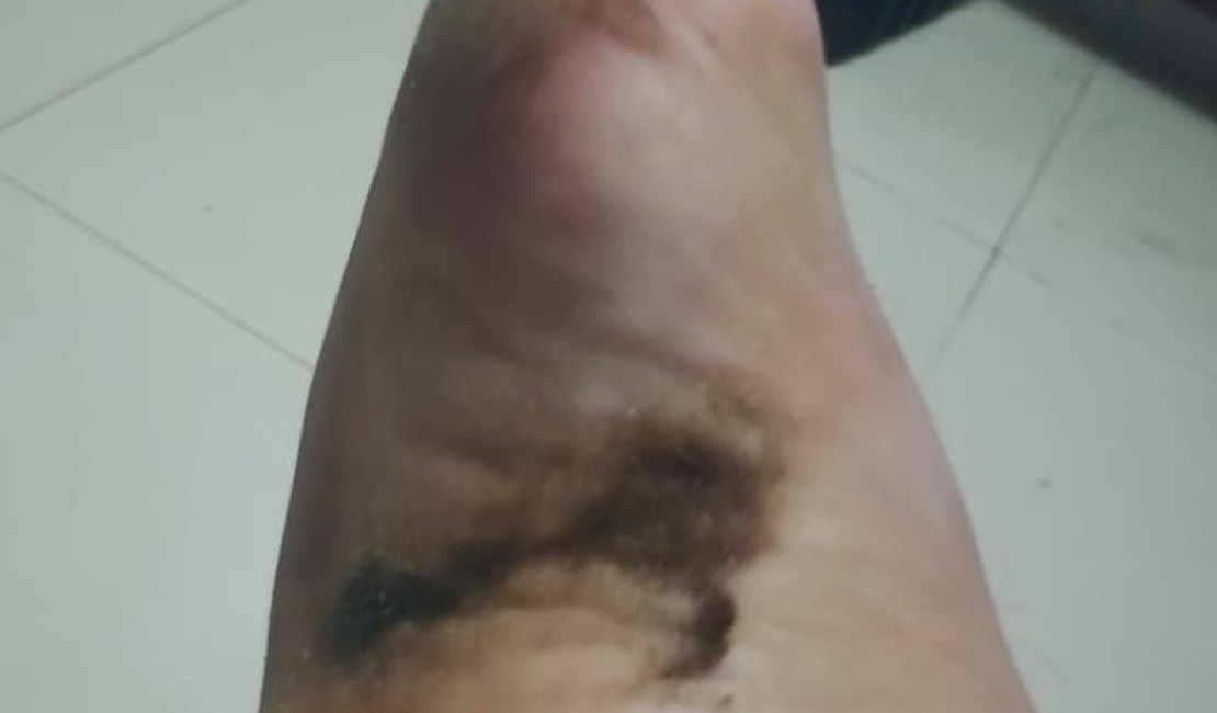 Manchas de óleo são encontradas na Praia do Francês, litoral sul de Alagoas