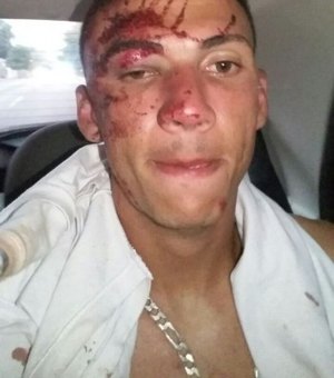 Goleiro do Coruripe é agredido durante tentativa de assalto em frente a sua residência