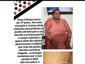 Família e amigos pedem ajuda para custear cirurgia no joelho de idosa
