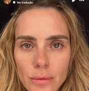 Carolina Dieckmann divulga foto sem filtro: 'Felizinha com minha pele'