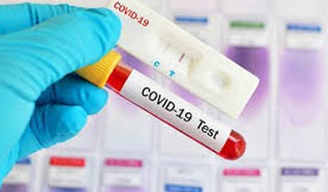 Arapiraca tem registrado média diária de 150 novos casos de Covid-19 e já soma 6.339 infectados