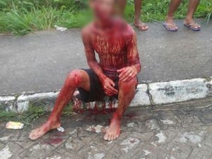Jovem fica gravemente ferido após ser atacado a golpes de facão