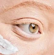 Pessoas com albinismo terão acesso gratuito a protetor solar em Maceió