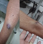 Médica é denunciada pelo MPAL por agredir tia idosa de 77 anos em Arapiraca