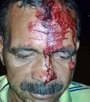 Criminosos apedrejam caminhoneiro na tentativa de roubar carga em São Miguel 