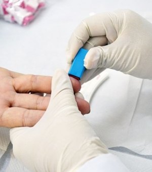 Helvio Auto fará testes para detectar hepatites B e C abertos à população