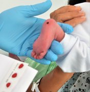 Teste do Pezinho está disponível pelo SUS nos 102 municípios alagoanos