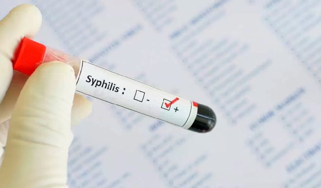 Saúde orienta população sobre cuidados contra a sífilis