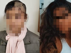 Bombeiro é acusado de raspar o cabelo da própria filha por ciúmes