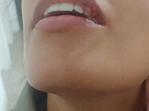 Policial é agredida durante ação em São Miguel dos Milagres