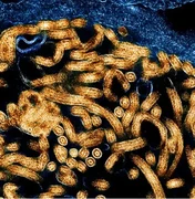 Surto: CDC da África confirma 395 casos de ebola e 106 mortes